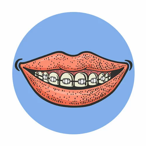 Цветной вариант раскраски брекеты рот зубы